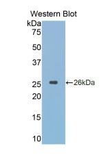 Cathepsin K (CTSK) Rhesus monkey (Simian) Monoclonal Antibody
