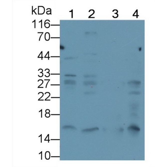 Histone H3 (H3) Human Monoclonal Antibody