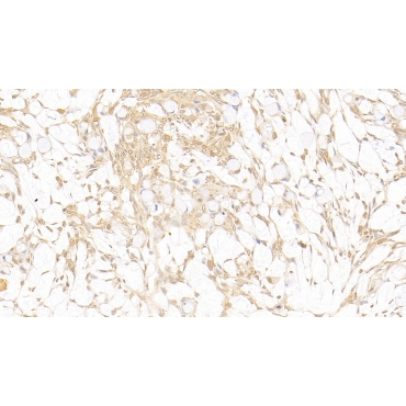 Galectin 3 (GAL3) Human Monoclonal Antibody