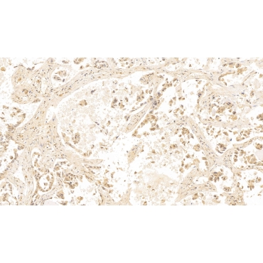 Galectin 3 (GAL3) Human Monoclonal Antibody
