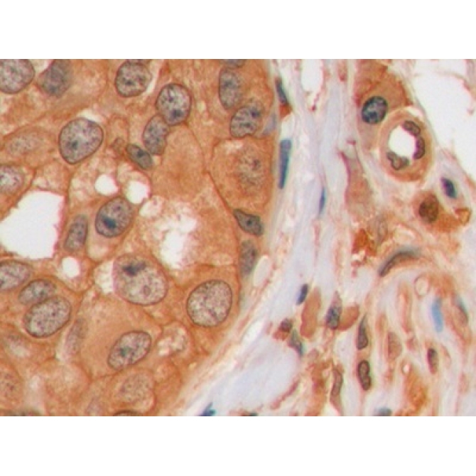 Galectin 3 (GAL3) Human Monoclonal Antibody