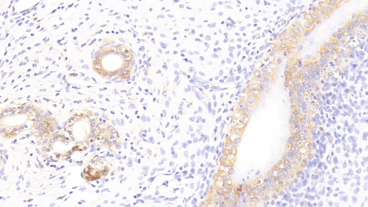 Galectin 3 (GAL3) Rat Monoclonal Antibody