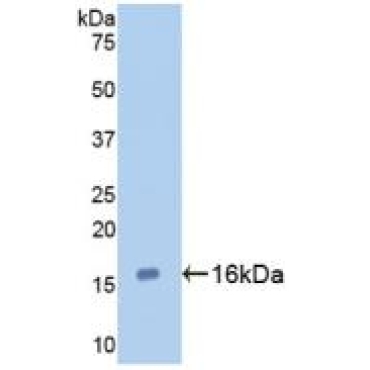 Galectin 7 (GAL7) Human Monoclonal Antibody