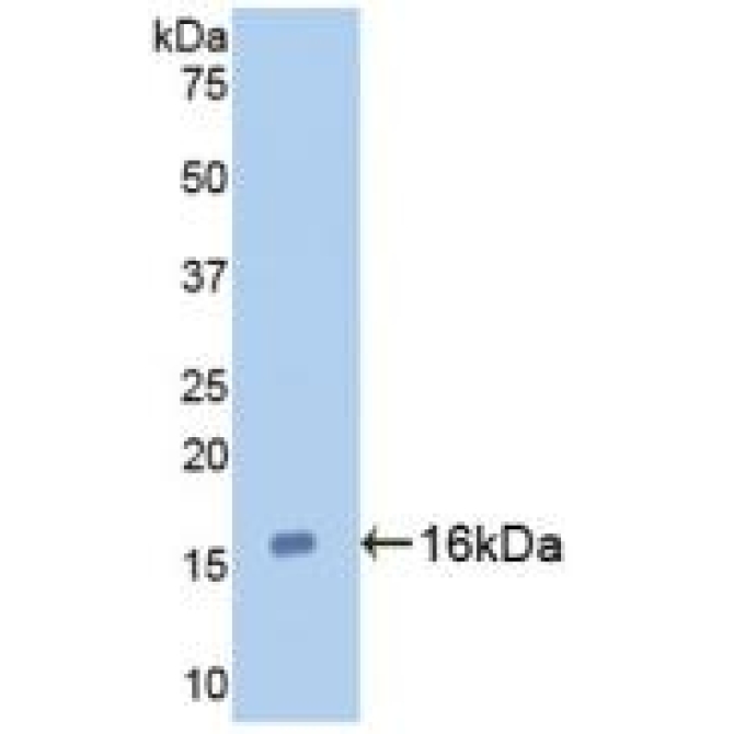 Galectin 7 (GAL7) Human Monoclonal Antibody