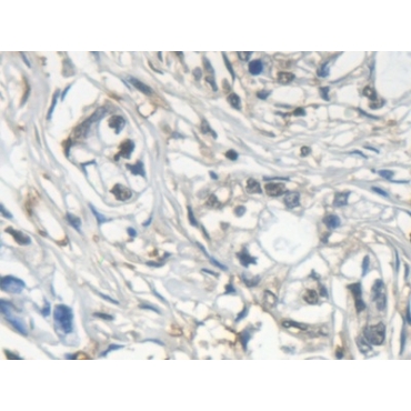 Galectin 7 (GAL7) Human Monoclonal Antibody