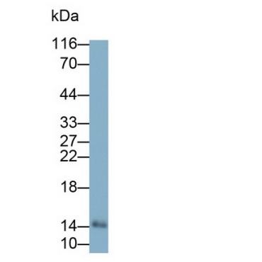 Galectin 7 (GAL7) Human Monoclonal Antibody