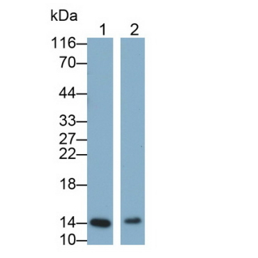 Galectin 7 (GAL7) Human Monoclonal Antibody