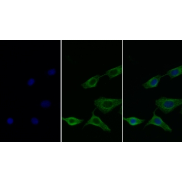 Galectin 8 (GAL8) Human Monoclonal Antibody
