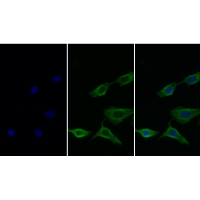Galectin 8 (GAL8) Human Monoclonal Antibody
