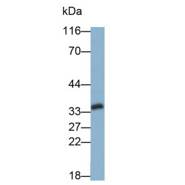 Galectin 8 (GAL8) Human Monoclonal Antibody