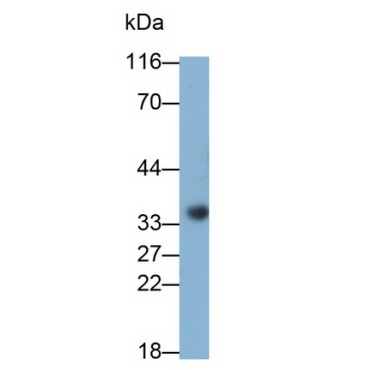 Galectin 8 (GAL8) Human Monoclonal Antibody