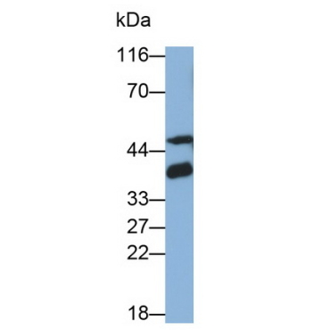 Galectin 8 (GAL8) Human Monoclonal Antibody