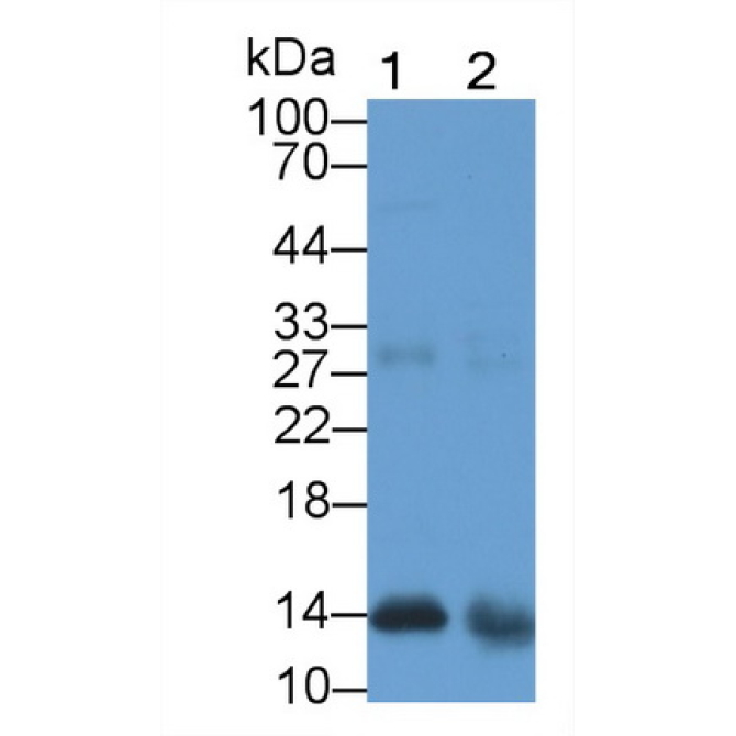 Galectin 1 (GAL1) Human Monoclonal Antibody