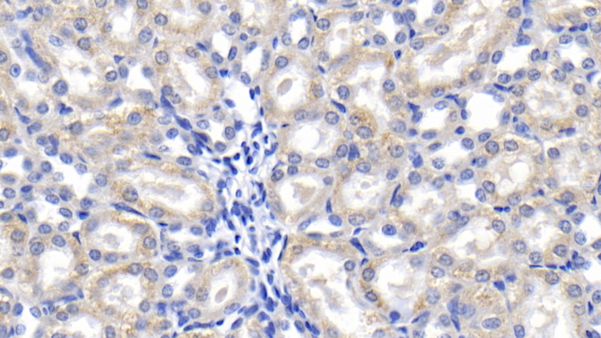 Galectin 1 (GAL1) Rat Monoclonal Antibody