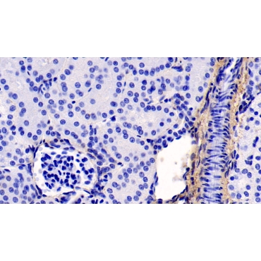 Collagen Type I Alpha 1 (COL1a1) Human Monoclonal Antibody