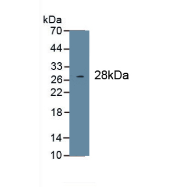 Collagen Type I Alpha 1 (COL1a1) Human Monoclonal Antibody