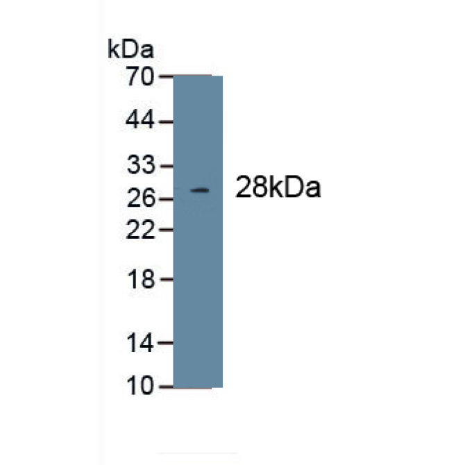 Collagen Type I Alpha 1 (COL1a1) Human Monoclonal Antibody
