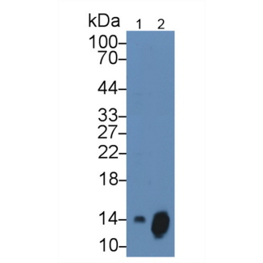 Chemokine (C-X-C motif) ligand 7 ( CXCL7) Human Monoclonal Antibody