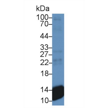 Chemokine (C-X-C motif) ligand 7 ( CXCL7) Human Monoclonal Antibody