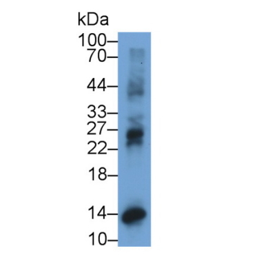 Interferon Gamma Induced Protein 10kDa (IP10) Human Monoclonal Antibody