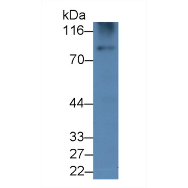 Gelsolin (GSN) Human Monoclonal Antibody