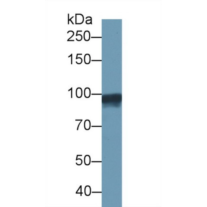 Gelsolin (GSN) Human Monoclonal Antibody