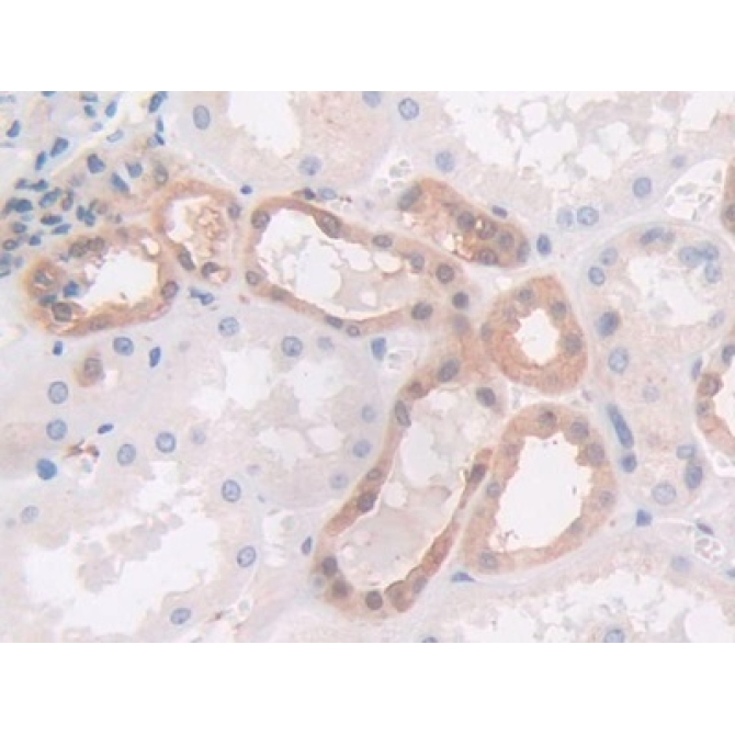 Gelsolin (GSN) Human Monoclonal Antibody