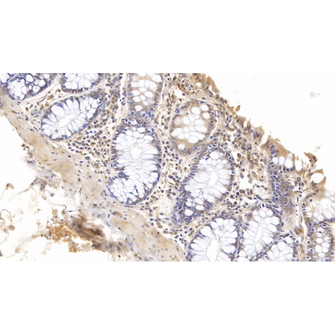 Gelsolin (GSN) Human Monoclonal Antibody