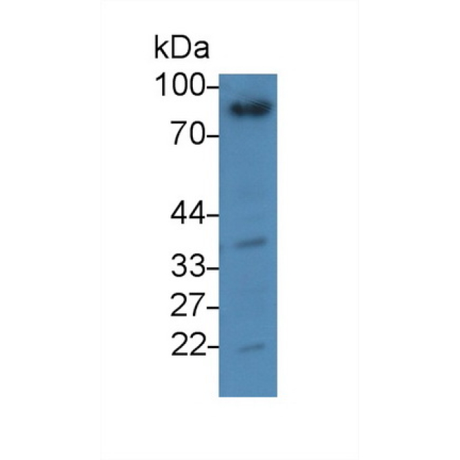 Gelsolin (GSN) Human Monoclonal Antibody