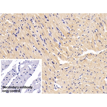 Desmin (Des) Human Monoclonal Antibody