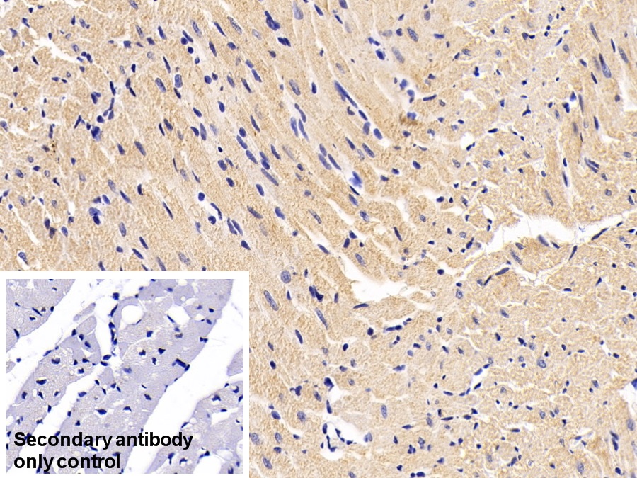 Desmin (Des) Human Monoclonal Antibody