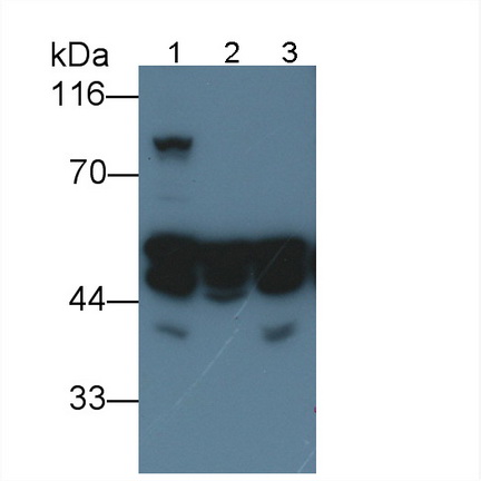 Desmin (Des) Human Monoclonal Antibody