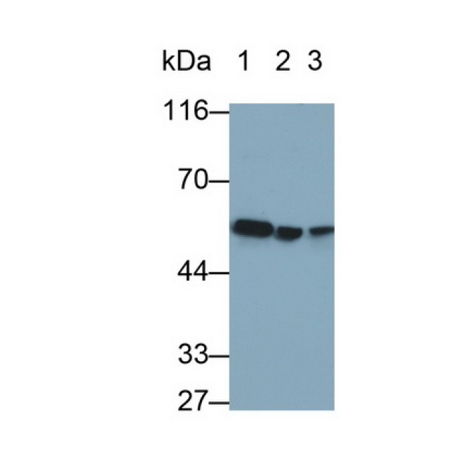 Desmin (Des) Human Monoclonal Antibody