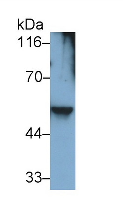 Desmin (Des) Human Monoclonal Antibody