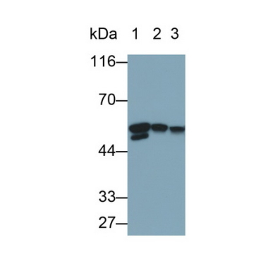 Desmin (Des) Human Monoclonal Antibody