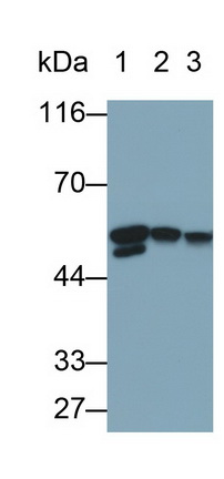 Desmin (Des) Human Monoclonal Antibody