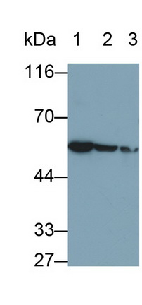 Desmin (Des) Human Monoclonal Antibody