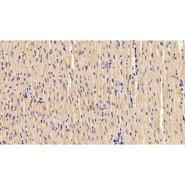 Desmin (Des) Human Monoclonal Antibody