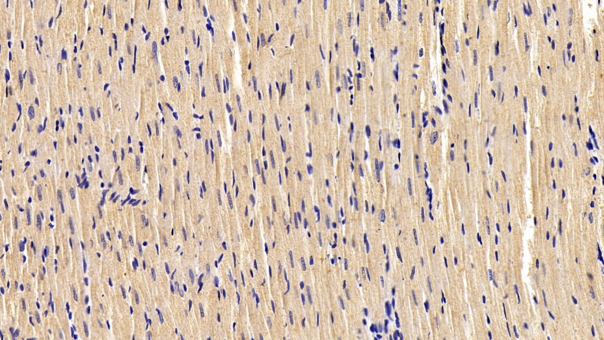Desmin (Des) Human Monoclonal Antibody
