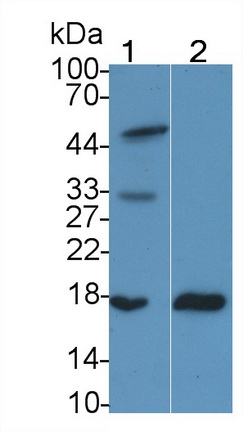 Retinol Binding Protein 2, Cellular (RBP2) Human Monoclonal Antibody