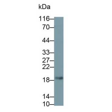 Vasoactive Intestinal Peptide (VIP) Human Monoclonal Antibody