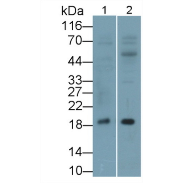 Vasoactive Intestinal Peptide (VIP) Human Monoclonal Antibody