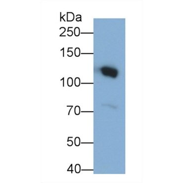 Complement Component 3a (C3a) Human Monoclonal Antibody