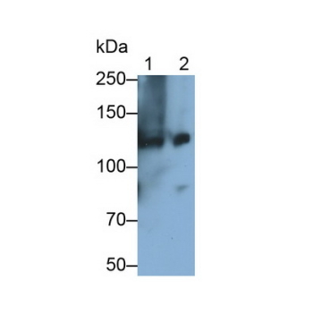 Complement Component 3a (C3a) Human Monoclonal Antibody