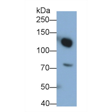 Complement Component 3a (C3a) Human Monoclonal Antibody