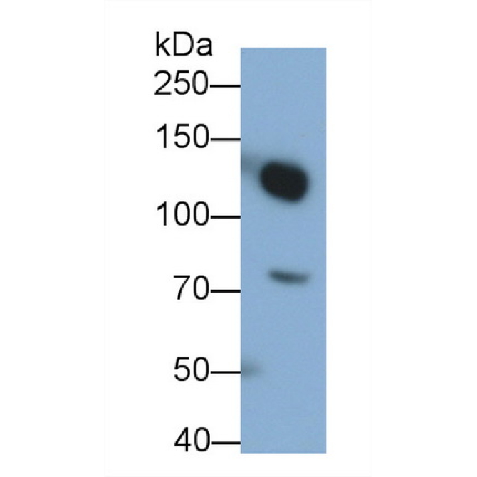 Complement Component 3a (C3a) Human Monoclonal Antibody