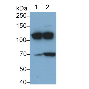 Complement Component 3a (C3a) Human Monoclonal Antibody