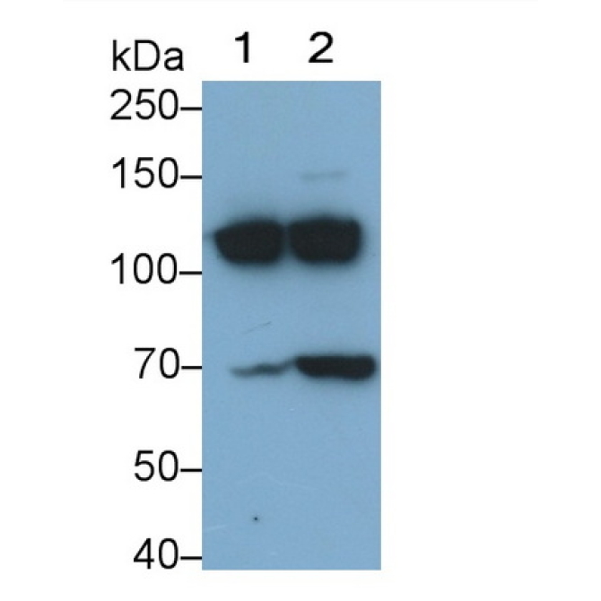 Complement Component 3a (C3a) Human Monoclonal Antibody