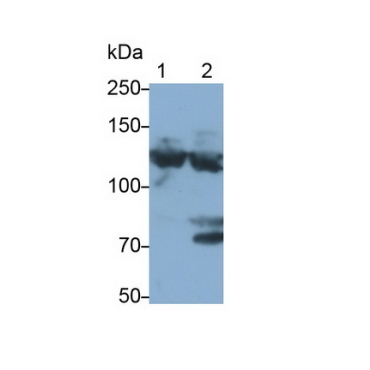 Complement Component 3a (C3a) Human Monoclonal Antibody