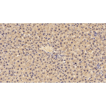 Complement Component 3a (C3a) Human Monoclonal Antibody